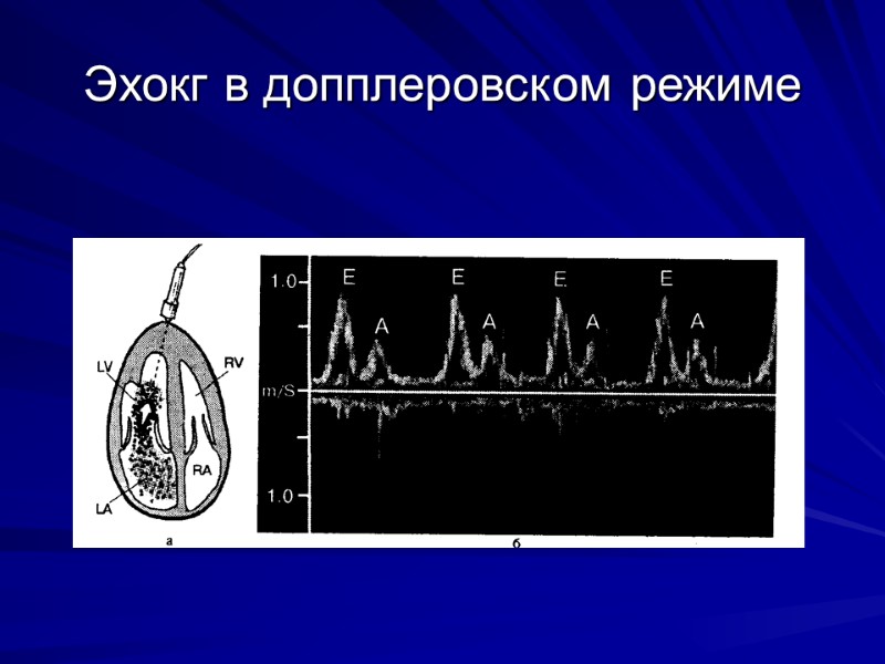 Эхокг в допплеровском режиме